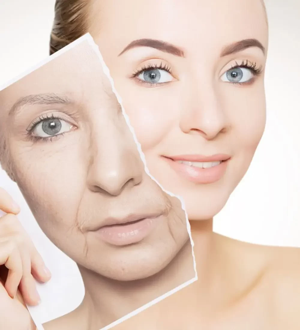 Antiageing Treatments (1)