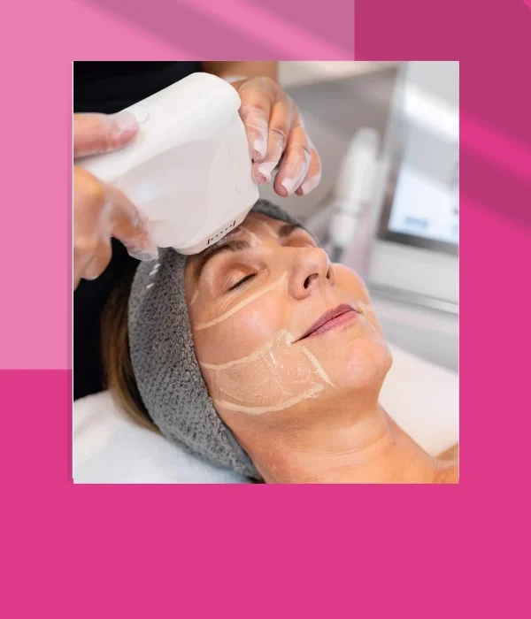 LASER SKIN TIGHTENING